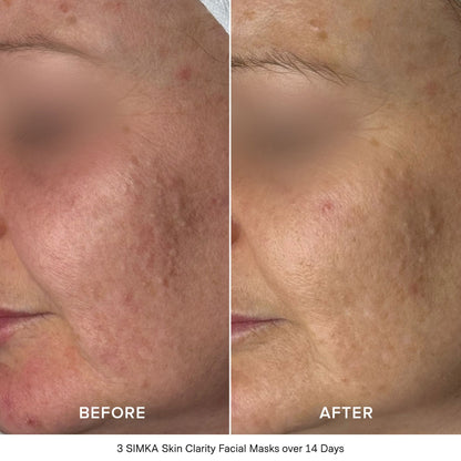 Skin Clarity Bio-Cellulose Facial Mask (4 Pack)