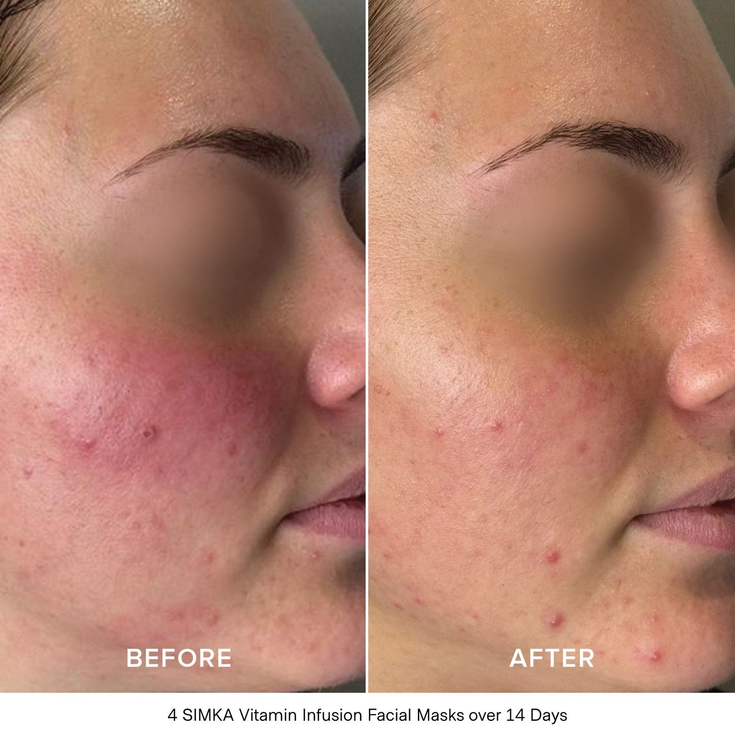 Vitamin Infusion Bio-Cellulose Facial Mask (4 Pack)